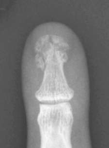 Xray1.gif